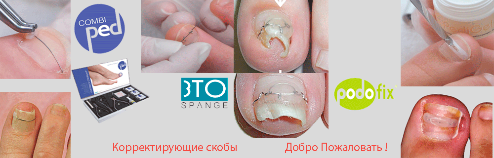 3ТО, Подофикс и Комбипед 3ТО, Подофикс и Комбипед